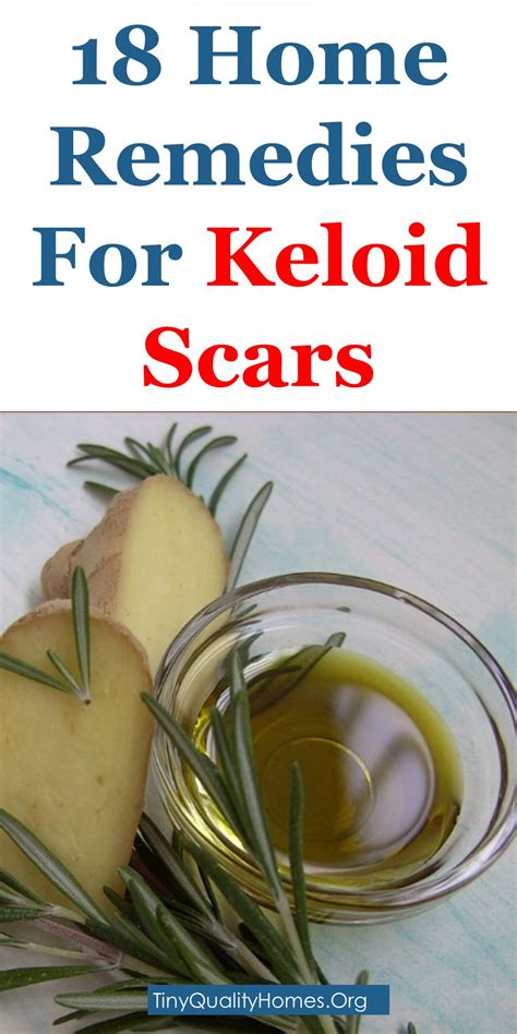 How To Get Rid Of Keloid Scars 18 Effective Home Remedies