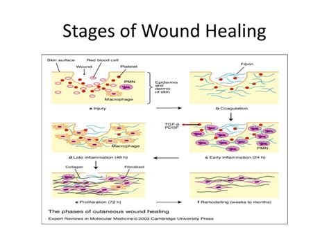 Ppt Wound Healing Powerpoint Presentation Free Download Id2227125