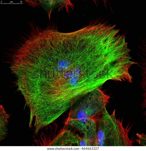 Real Fluorescence Microscopic View Human Skin Stock Photo 464663327