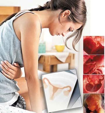 Bahasa inggerisnya ialah ectopic pregnancy. Kehamilan di Luar Rahim