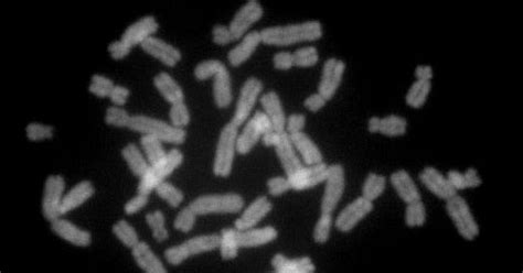 Female Chromosome May Play Unexpected Role In Male Biology Wired