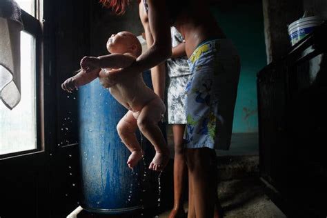 birth defects in brazil may be overreported amid zika fears the new york times