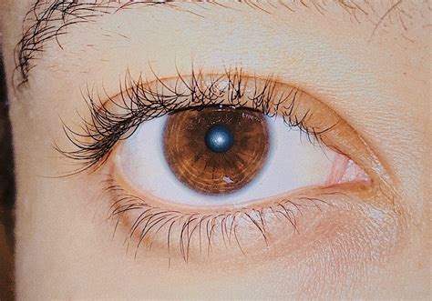 Tipos De Heterocromia Central