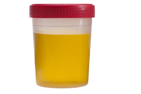 Just What Is Cloudy Urine Its Appearance And Color Scary Symptoms