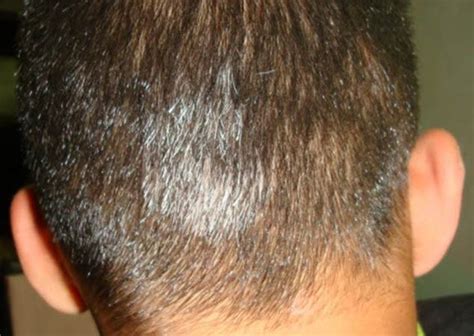 Having Grey Hair At Early Age Know About These 6 Factors Responsible