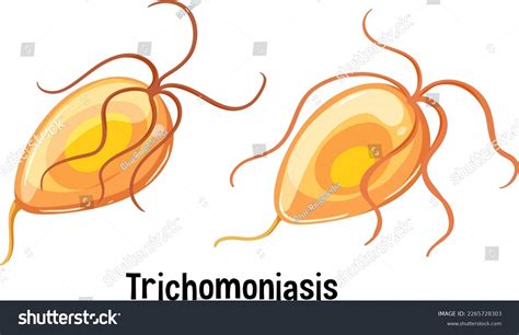 Trichomonas Vaginalis Text Illustration Stock Vector Royalty Free