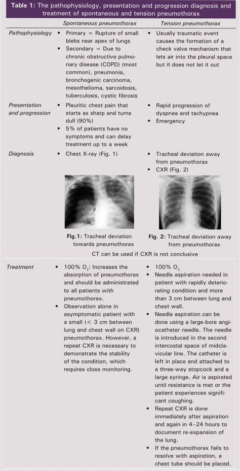 Spontaneous Pneumothorax Vs Tension Pneumothorax Pathophysiology