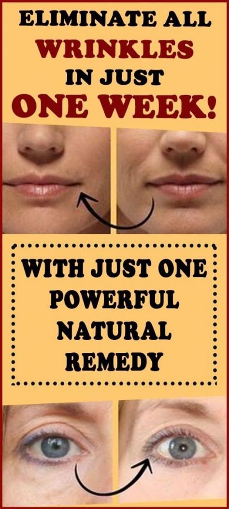 How To Get Rid Of Wrinkles Naturally In Just One Week In 2020 Natural