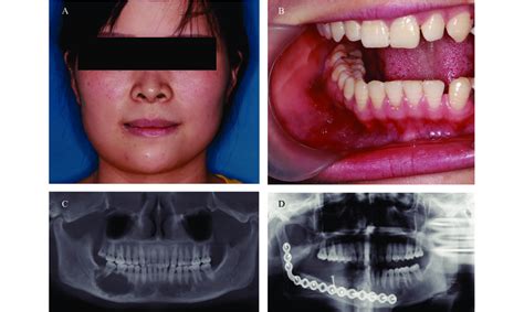 Photos Of Facial Landscape And Oral Cavity And The Preoperative Or