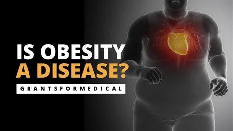 Is Obesity A Disease Grants For Medical