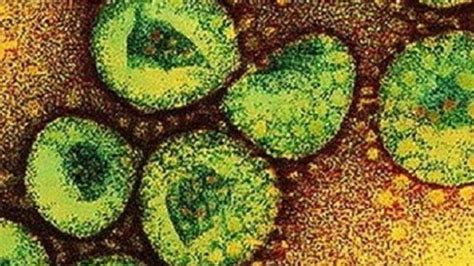 Benarkah Virus Corona Bisa Hidup dan Menular Lewat Benda Mati? Ini Kata
