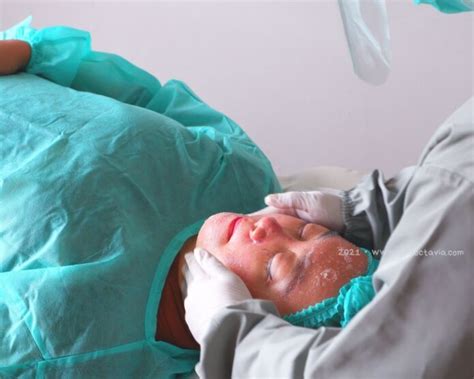 Pengalaman ERHA Ultimate Acne Cure Di Erha Derma Center Bandung