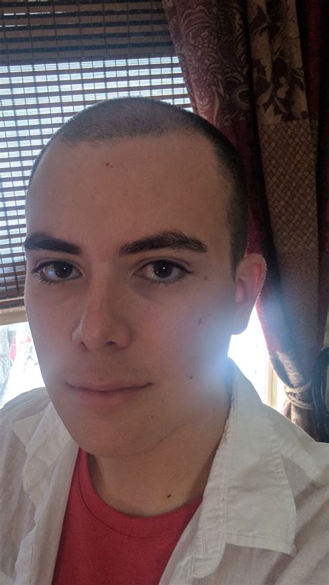 In other cases, thinning hair is triggered by something going on inside the body — for instance, a thyroid problem, a shift in hormones, a recent pregnancy, or an inflammatory condition. 26MtF, HRT for 10 Months. besides my hair (obviously) what ...