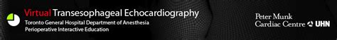Virtual Tee Toronto Standard Views Cardiac Transesophageal