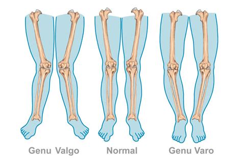 Podología Integral Clínica Vascular Marbella Cirujano Vascular en Marbella