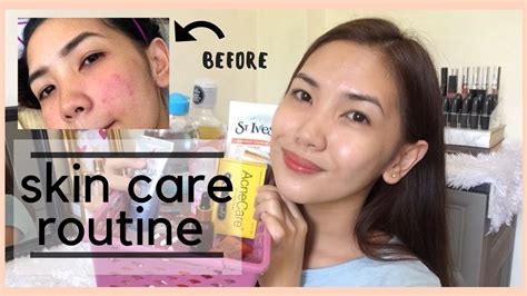 Skin Care Routine For Acne Prone Skin Lahat Below 280 Pesos 2018