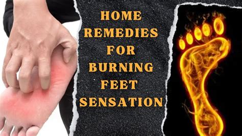 Burning Sensation In Feet Causes And Remedies Burning Feet Sensation Relief Youtube