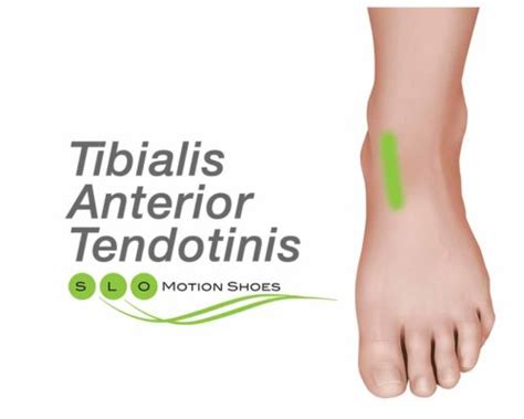 Tibialis Anterior Tendon