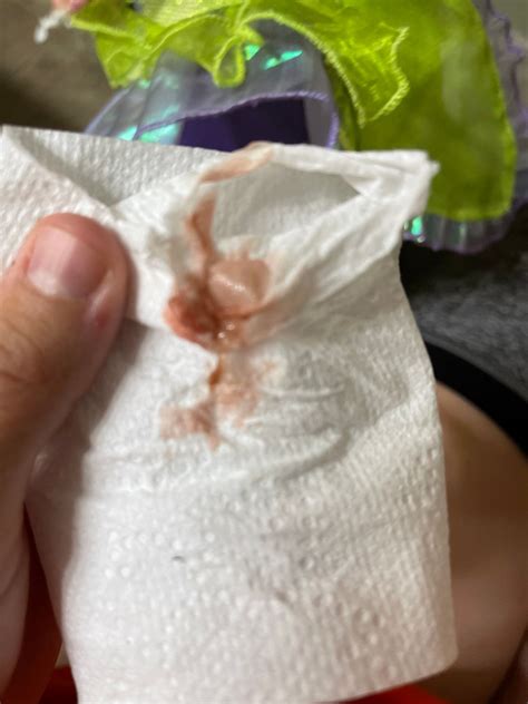 Could This Be Implantation Bleeding Tmi Pics Babycenter