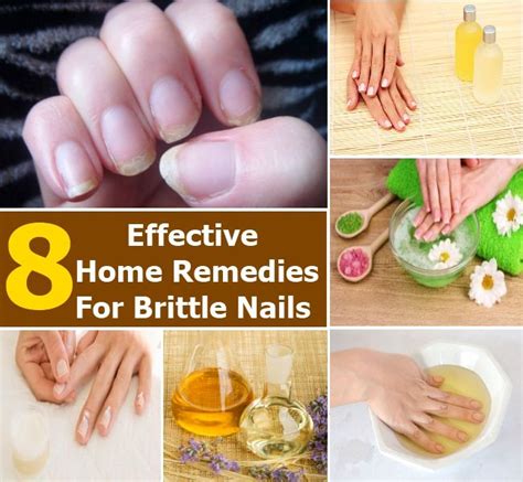 8 Effective Home Remedies For Brittle Nails Brittle Nails Nail