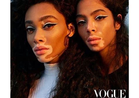 Beautiful Black Models With Vitiligo Cover Vogues June 2019 Issue