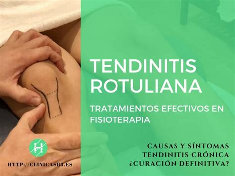 Tendinitis Rotuliana Tratamiento En Fisioterapia Causas
