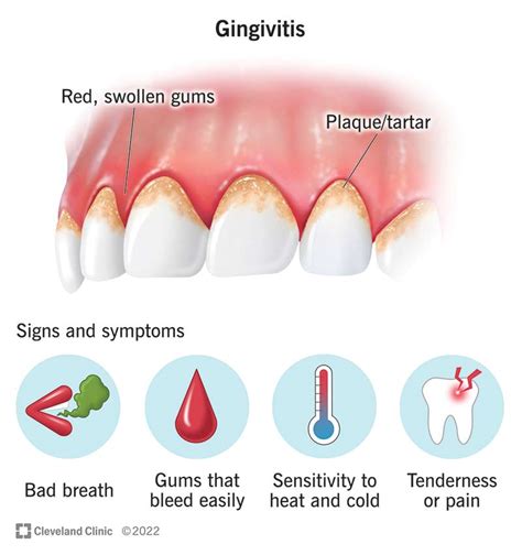 Causes And Symptoms Of Gum Swelling And How To Take Care Of It 블록
