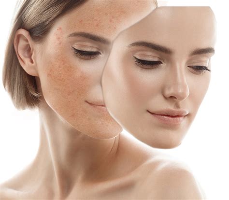 Bb Glow Para Que Serve