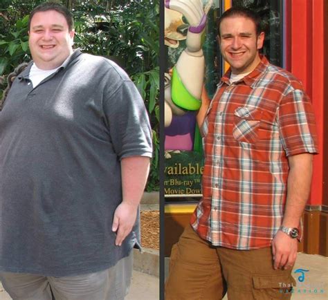 15 Captivating Weight Loss Surgery Before And After Sleeve Best