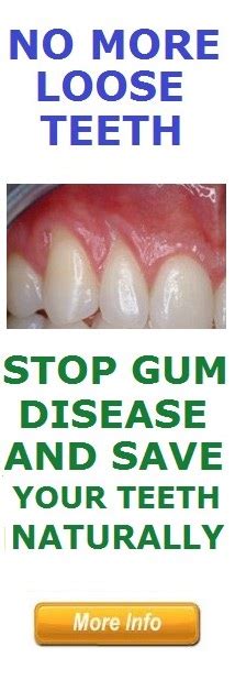 This can occur with severe gum disease or from unresolved teeth grinding. Loose Teeth In Adults Can Be Saved If You Act Quickly ...