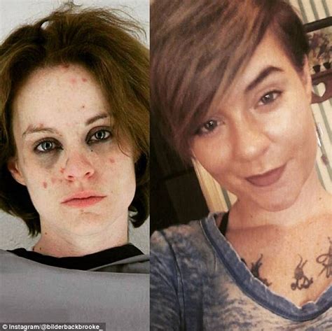 Former Addicts Share Amazing Before And After Photos Daily Mail Online