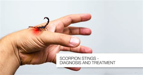 Scorpion Stings Diagnosis And Treatment