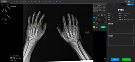 Better Outcomes With AI-Based Medical Imaging | insight.tech
