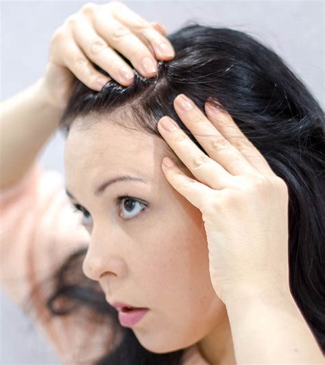 Causes And Treatment For Scabs And Sores On Scalp My Beautiful Adventures