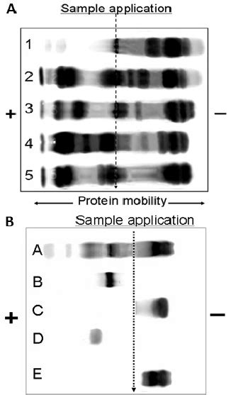 Protein Mobility Of A Taipan Venoms 1 O Temporalis 2 O
