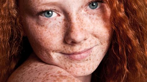 Why Do Some People Especially Red Heads Have Freckles Mental Floss