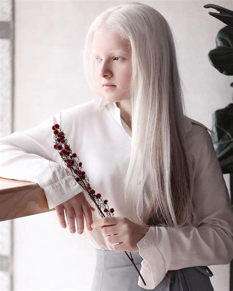 Stunning Portraits Of 11 Year Old Girl With Albinism And Heterochromia
