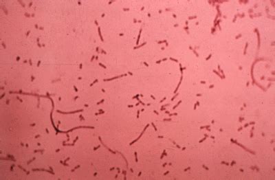 Always seek the advice of your physician or other qualified health provider with any questions you may have regarding a medical condition. Haemophilus influenzae gram stain - pink pleomorphic rods ...