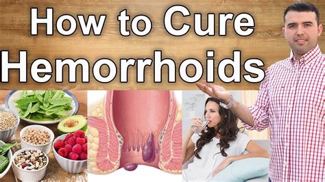 how to cure hemorrhoids naturally causes diet and natural treatments youtube