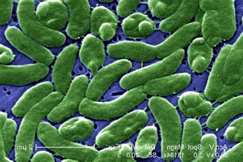 Free Picture Grouping Cells Vibrio Vulnificus Bacteria Photomicrograph