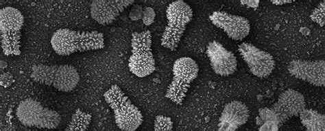 These Viruses Found In Brazil Are So Huge They Re Challenging What We Think A Virus Is