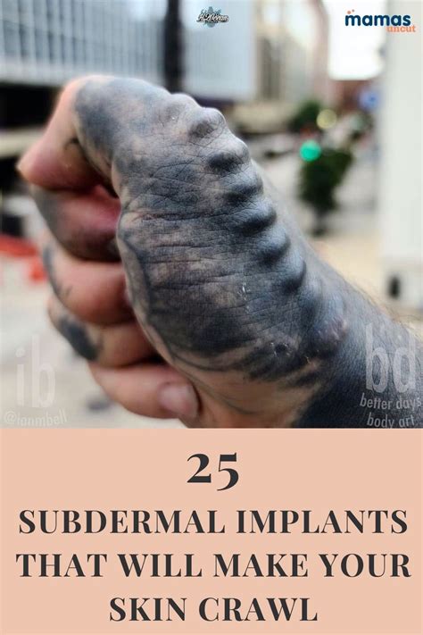 Subdermal Implants That Will Make Your Skin Crawl Body Modification Piercings Implants