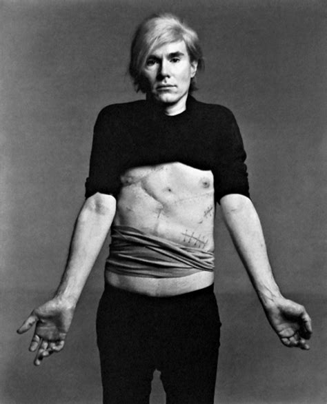 Why Did Andy Warhol Die
