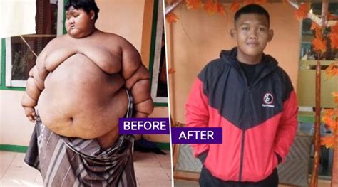 Indonesias Fattest Teenager Arya Permana Loses 110kg Amazing Body Transformation With Before