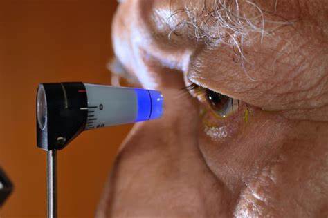 Eye test permit early identification of Alzheimer