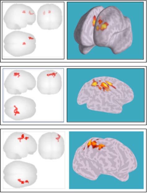 Figure 5 From Development Of Emotion Regulation Neural Circuitry