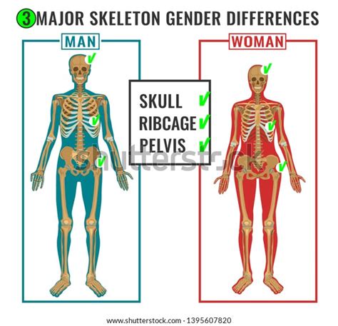 Skeleton Differences Poster Male Comparison Female 스톡 일러스트 1395607820