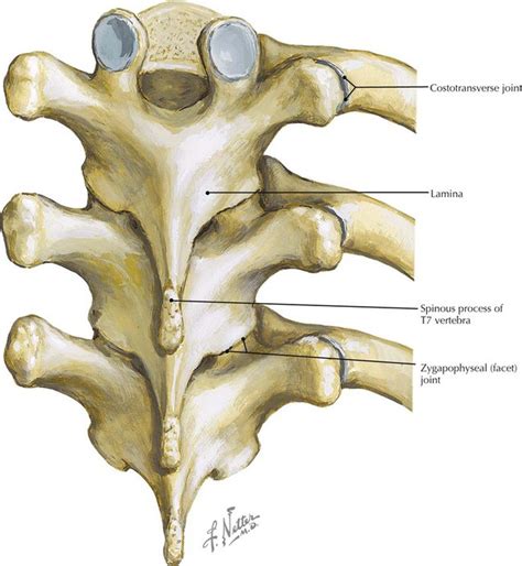 Back And Spinal Cord Radiology Key