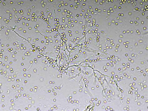 Yeast Cells Under Microscope 40x