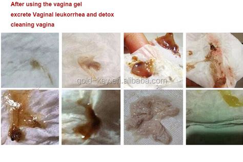 Vaginal Discharge Vagina Tightening Gel Let Sex Old Woman Have